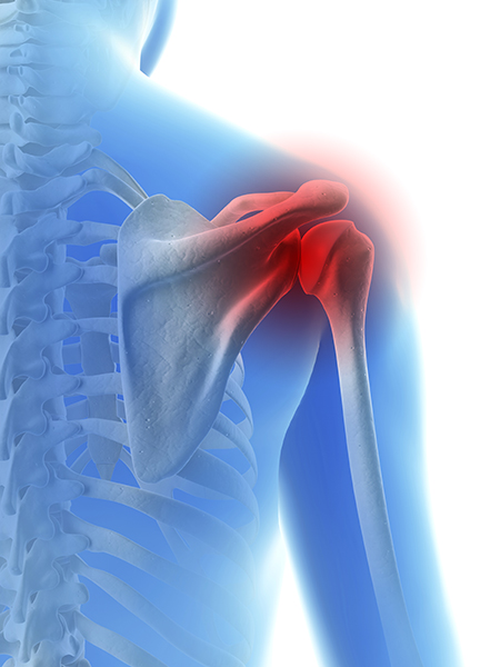 Baseball Injuries Treatment Denver, CO | Shoulder Injuries Treatment Aurora