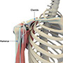 Shoulder Joint Tear