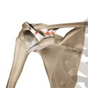 Acromioclavicular Joint (AC joint) Dislocation